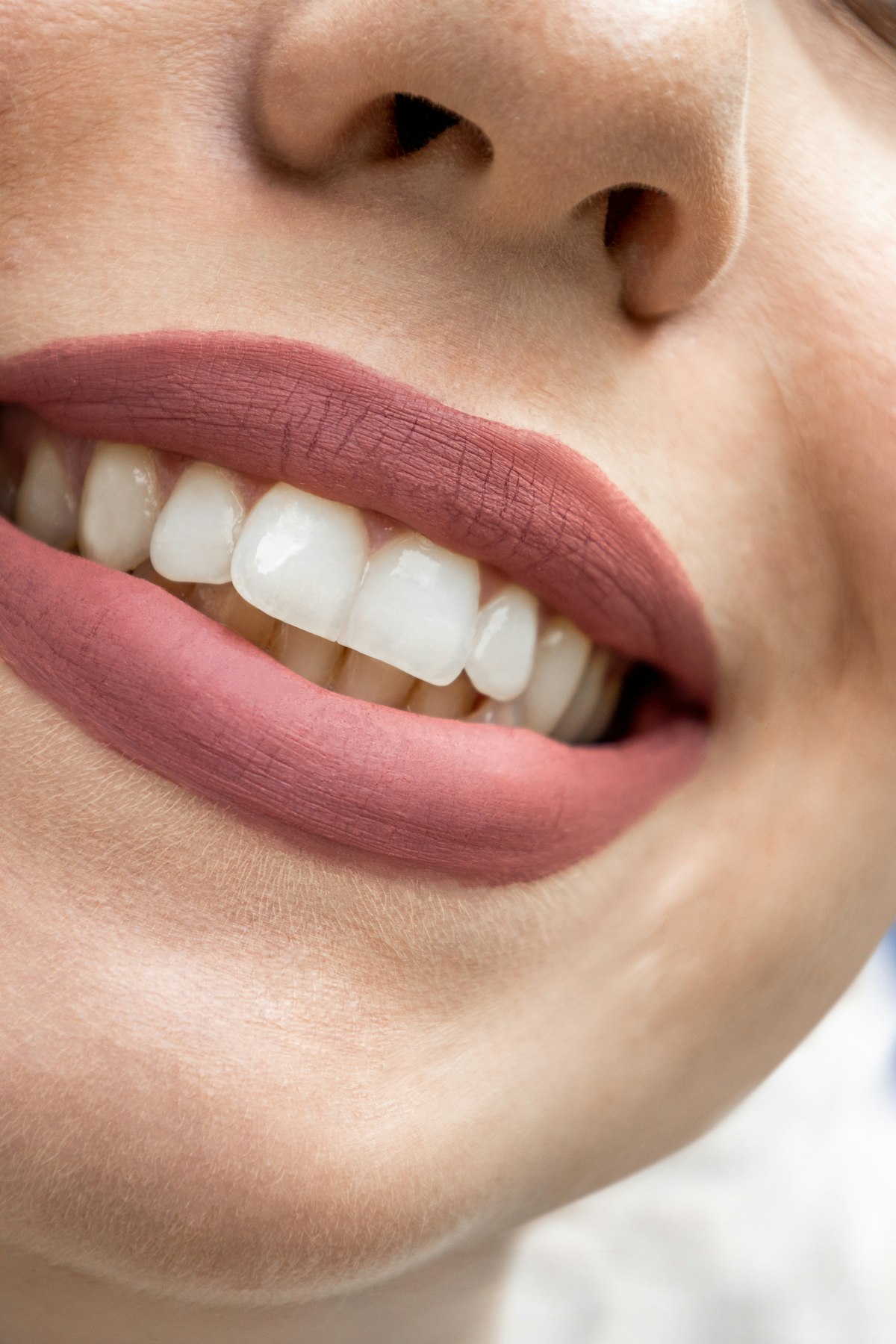 Clareamento dental caseiro